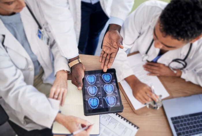 Three people in white coats holding an ipad with images of a brain
