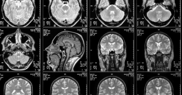 Bildet kan inneholde: fotografi, produkt, svart, medisinsk bildediagnostikk, computertomografi.
